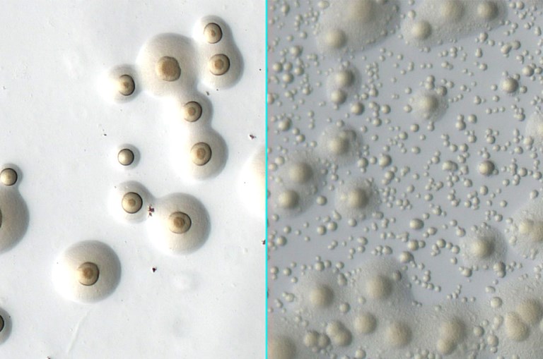 Mycoplasma composite image