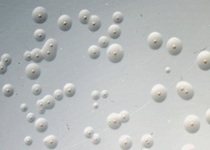 Acholemplasma equirhinis cells