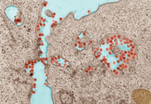 chikungunya in vero cells