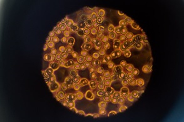 Blood cells through microscope