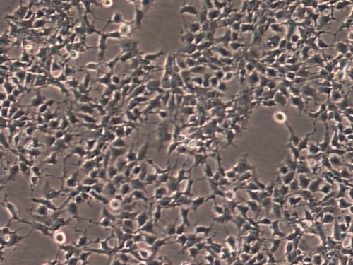Sticky Issues with 293 Cells | Culture Collections