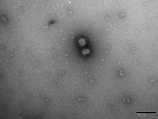 TEM image of NCPV 1409231v MERS Coronavirus 