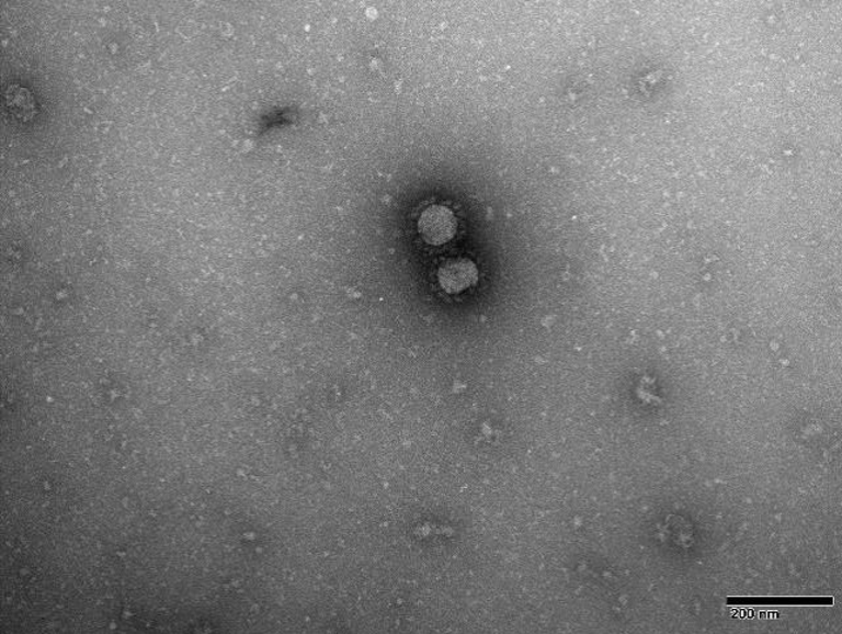 TEM image of NCPV 1409231v MERS Coronavirus 
